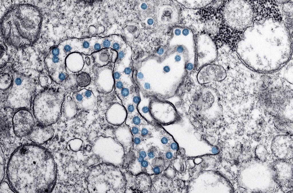 Boulder County reaches ‘community spread’ with four new COVID-19 cases