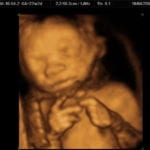 Over 130 Doctors and Scientists Support Colorado Measure to Ban Late-Term Abortions