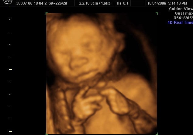 Over 130 Doctors and Scientists Support Colorado Measure to Ban Late-Term Abortions