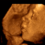 Colorado Voters Should Support Proposition 115 to Ban Late-Term Abortions