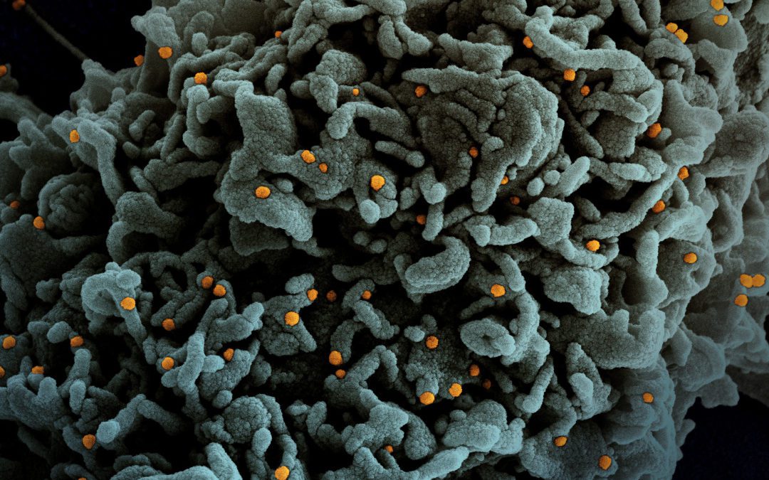 Here’s what you need to know about all the coronavirus variants circulating in Colorado