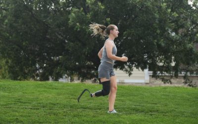 Colorado Springs woman known as ‘Footless Jo’ shares her journey of life after amputation