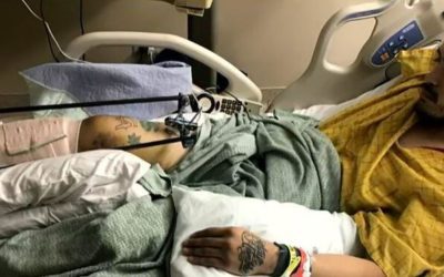 Man reflects on attack at Colorado Springs dog park: ‘A switch just went off in him’