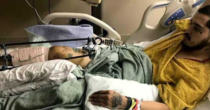 Man reflects on attack at Colorado Springs dog park: ‘A switch just went off in him’