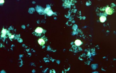 Strong new evidence suggests a virus triggers multiple sclerosis – STAT