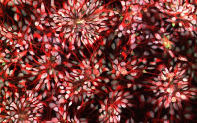 Study suggests new cause of Down syndrome: cells linked to aging – STAT